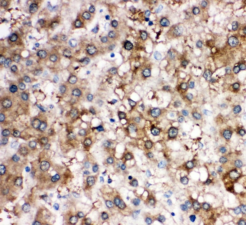 SERPINA6 / CBG Antibody (aa102-120)