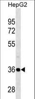 PSMD14 Antibody (aa258-287)