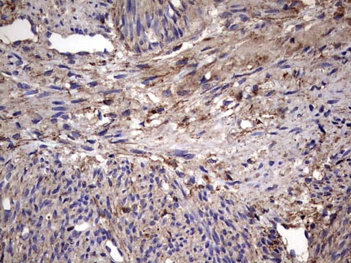IL1RN Antibody (clone OTI2B1)