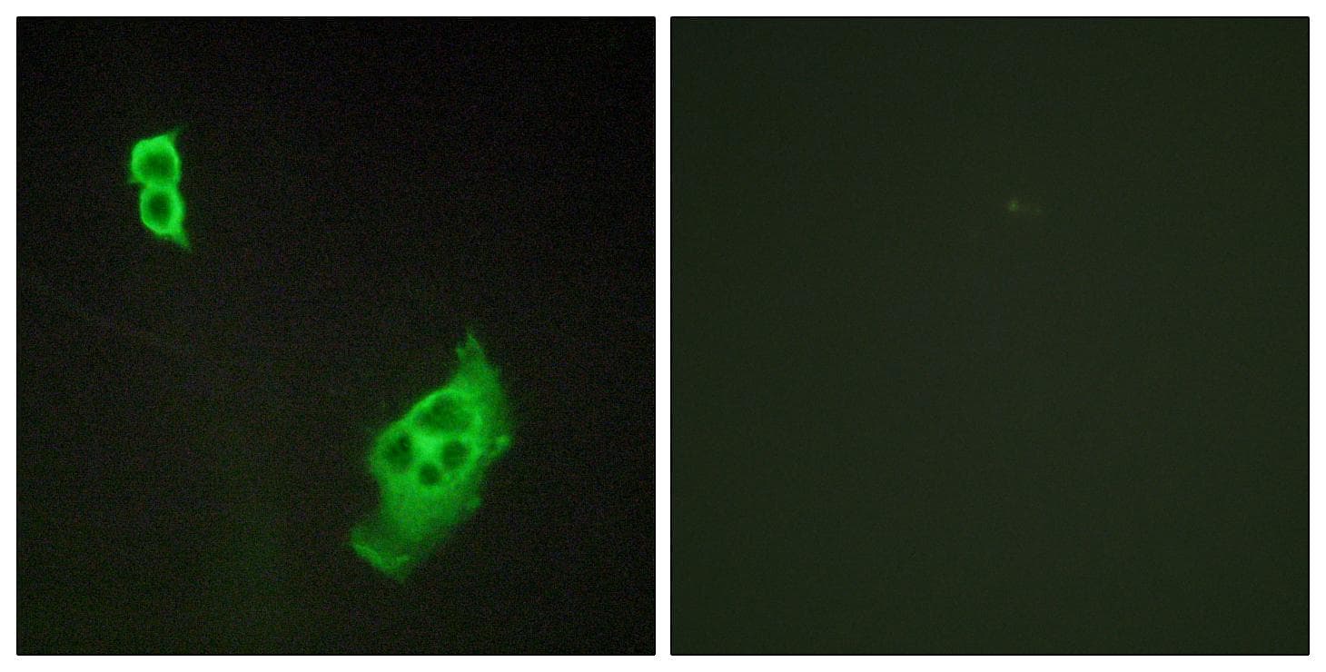 Polyclonal Rabbit anti-Human WASF1 / WAVE Antibody (p125, IHC, IF, WB)