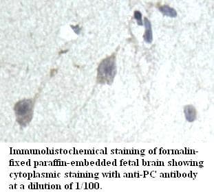 Polyclonal Rabbit anti-Human PC / Pyruvate Carboxylase Antibody (aa74-371, IHC, WB)