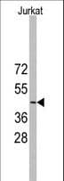 MSY2 / YBX2 Antibody (aa231-260)