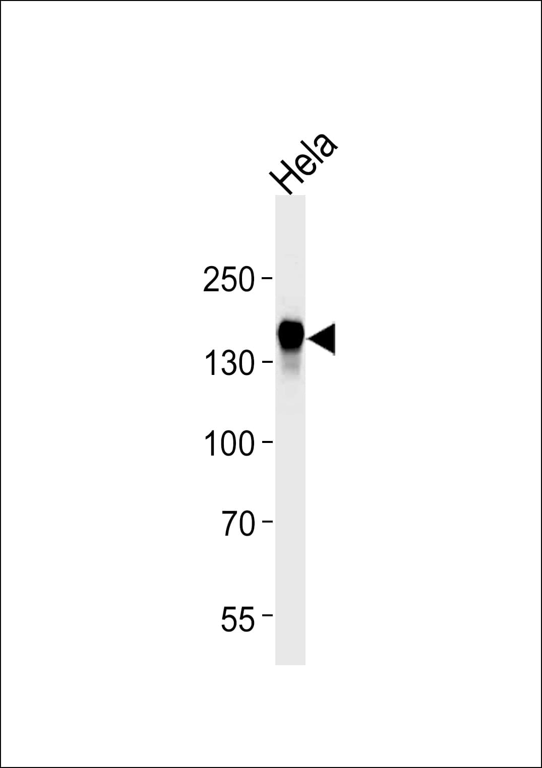 Monoclonal Mouse anti-Human EGFR Antibody (aa1163-1191, IHC, WB)