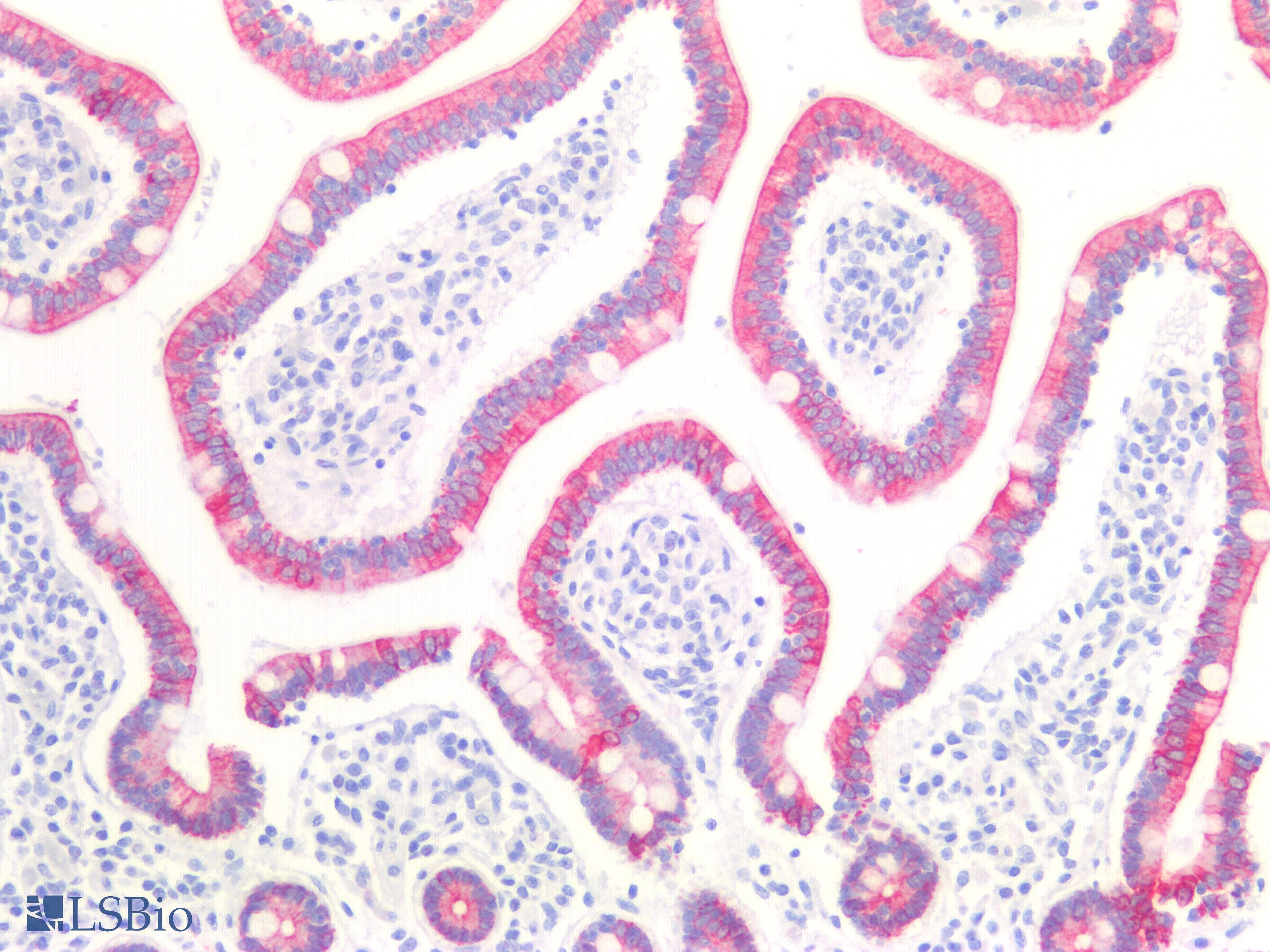 PathPlus™ KRT8 / CK8 / Cytokeratin 8 Antibody (Internal)