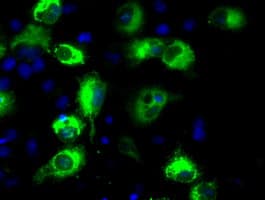 LOX / Lysyl Oxidase Antibody (clone OTI8G5)