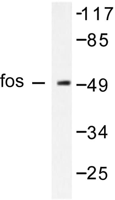 Polyclonal Rabbit anti-Human FOS / c-FOS Antibody (Phe3, IHC, WB)