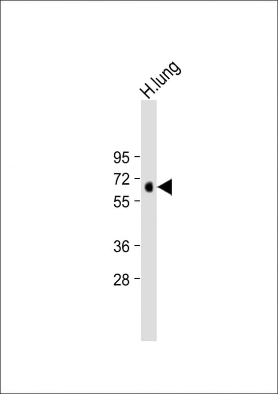 Polyclonal Rabbit anti-Human MKS1 Antibody (N-Terminus, WB)