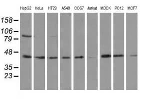 ALDH1L1 Antibody (clone OTI3B11, Carrier-free)