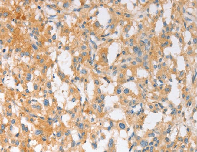 Polyclonal Rabbit anti-Human EPS15L1 / EPS15R Antibody (IHC, WB)