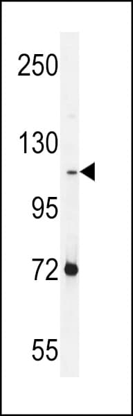 Polyclonal Rabbit anti-Human PCDHAC2 Antibody (aa616-644, IHC, IF, WB)