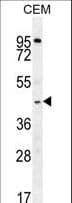 Polyclonal Rabbit anti-Human ZMYND10 Antibody (aa321-348, IHC, WB)