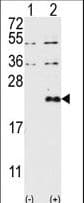 Polyclonal Rabbit anti-Human DUSP13 Antibody (aa1-30, IHC, WB)