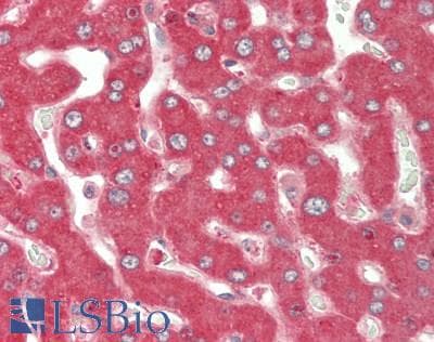 CP / Ceruloplasmin Antibody (aa789-1065)