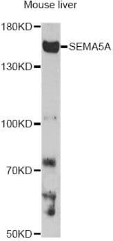 SEMA5A / Semaphorin 5A Antibody