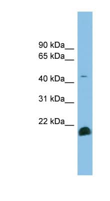 TGFB2 / TGF Beta2 Antibody (aa143-192)