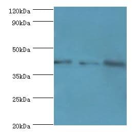 Polyclonal Rabbit anti-Human GRB4 / NCK2 Antibody (aa1-380, IHC, WB)