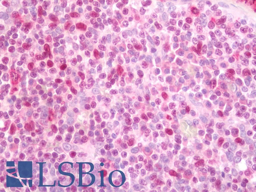SPI1 / PU.1 Antibody (FITC)