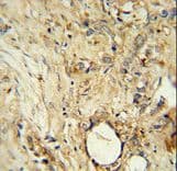 Polyclonal Rabbit anti-Human ITIH5 Antibody (aa578-606, IHC, WB)