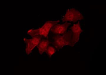 SRC Antibody (phospho-Tyr530)