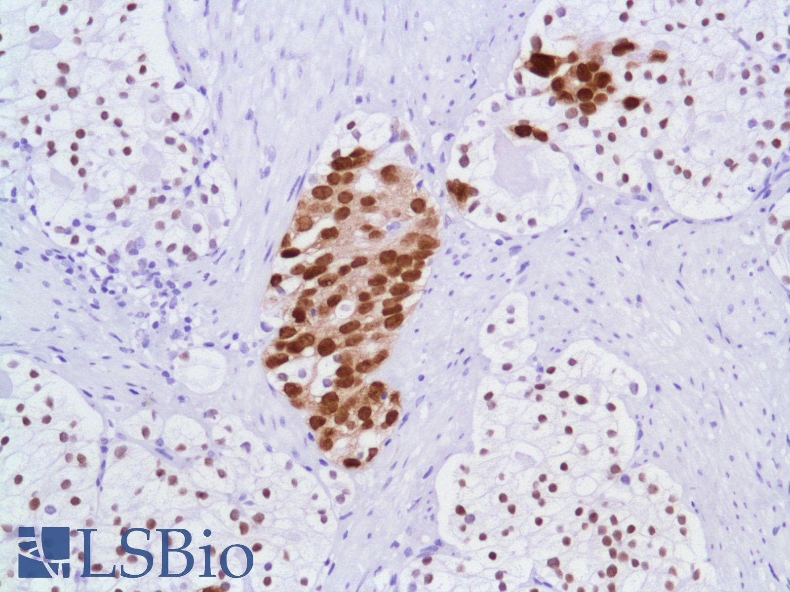 Monoclonal Rabbit anti-Human AR / Androgen Receptor Antibody (clone SP107, N-Terminus, IHC)