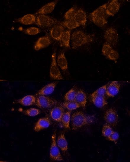 P450SCC / CYP11A1 Antibody
