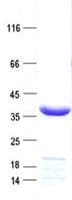 Human MMS21 / NSMCE2 Protein (Recombinant His, N-Terminal)