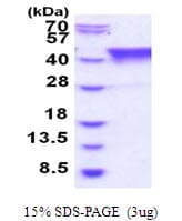 Human TIAL1 Protein (Recombinant His)