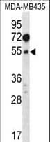 IHC-plus™ MAT / MAT1A Antibody (aa107-136)