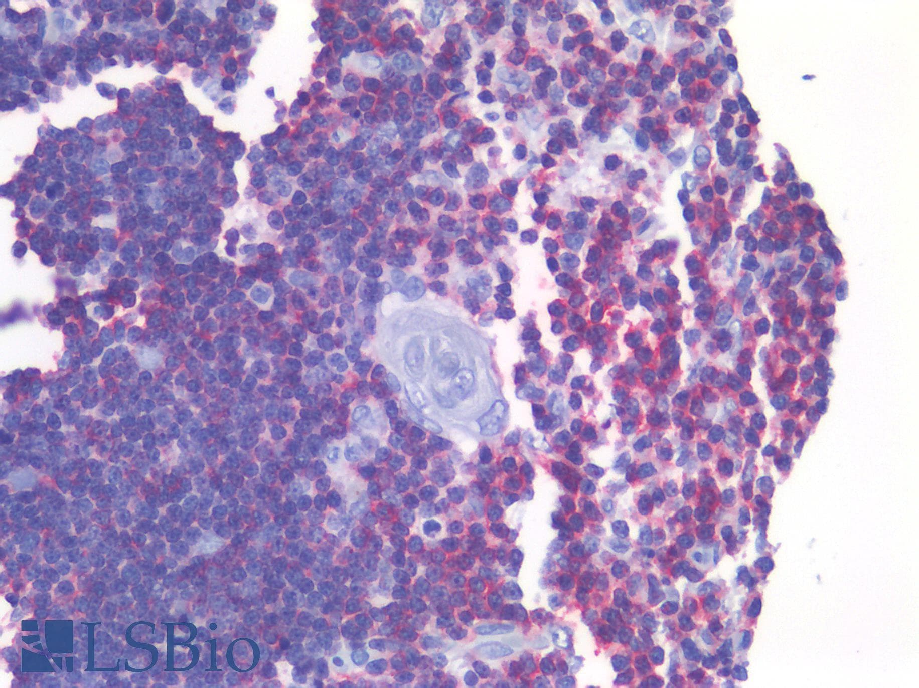 PathPlus™ LAT Antibody (Cytoplasmic Domain, clone LAT1111)