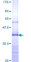 Human IL17RA Protein (Recombinant GST, N-terminus)