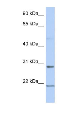Polyclonal Rabbit anti-Human C12orf53 Antibody (aa107-156, WB)