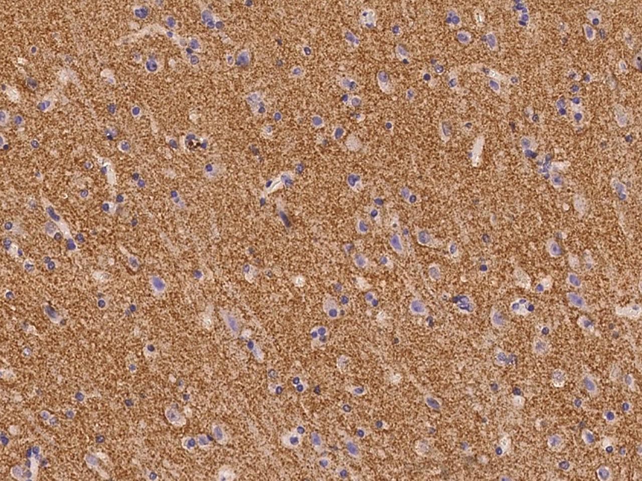Polyclonal Rabbit anti-Human SV2B Antibody (IHC)