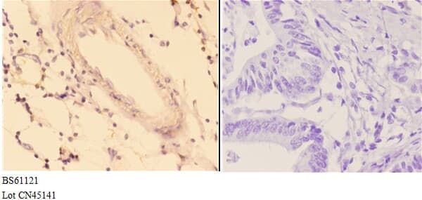 ACOT9 Antibody