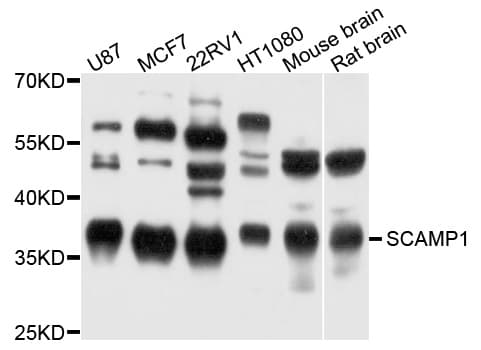 Polyclonal Rabbit anti-Human SCAMP1 / SCAMP Antibody (WB)