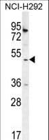 Polyclonal Rabbit anti-Human SH2D4A Antibody (aa38-67, IHC, WB)