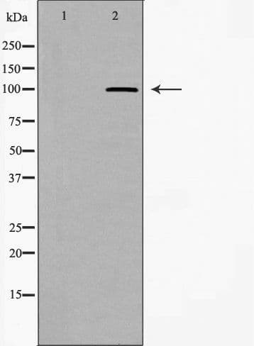 WFS1 Antibody
