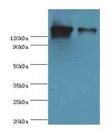 Polyclonal Rabbit anti-Human DIS / CCAR1 Antibody (aa1-200, WB)