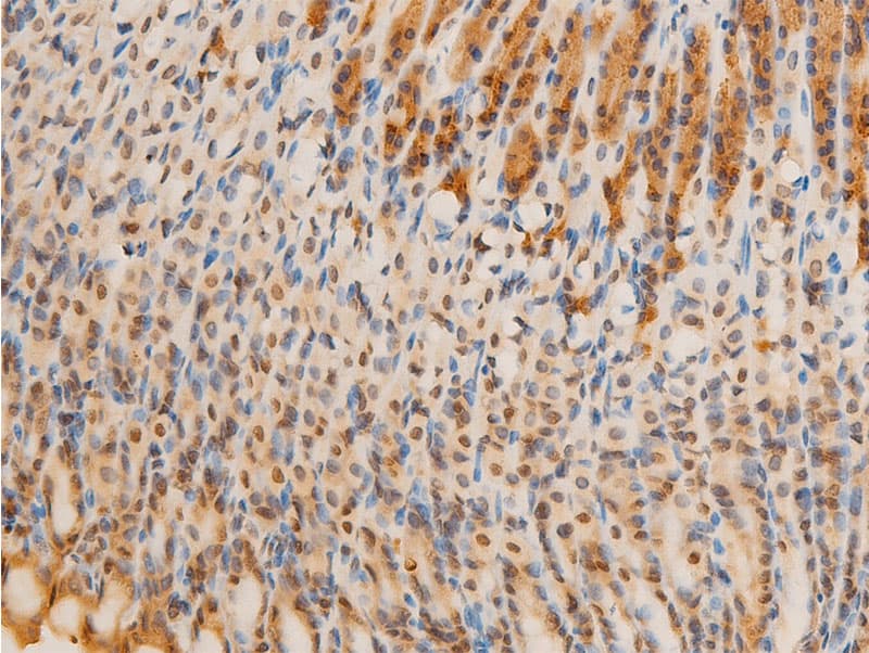 RELA / NFKB p65 Antibody (phospho-Ser536)