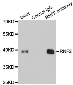 RNF2 / RING2 / RING1B Antibody