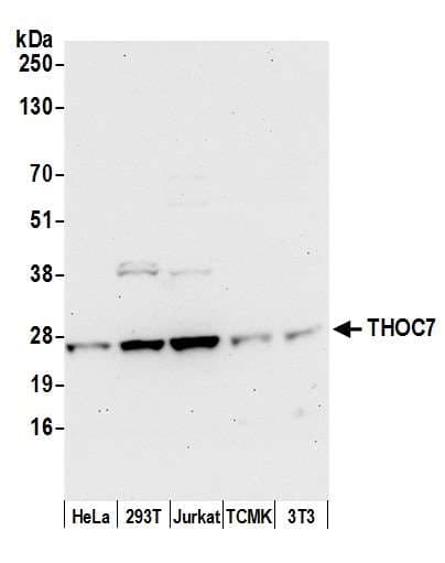 Polyclonal Rabbit anti-Human THOC7 Antibody (aa1-50, WB)