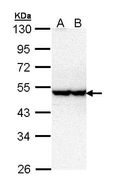 Polyclonal Rabbit anti-Human STK40 Antibody (aa156-372, WB)