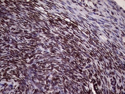 XRN2 Antibody (aa677-779, clone OTI5F4)