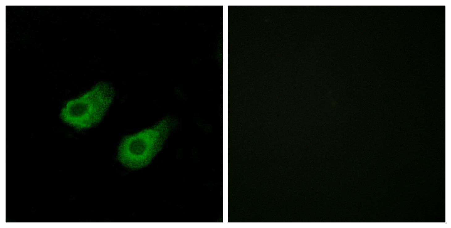 MAPK8IP3 / JIP3 Antibody