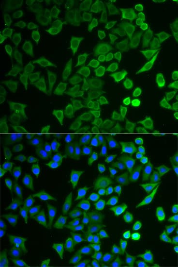 NPR2L / TUSC4 Antibody