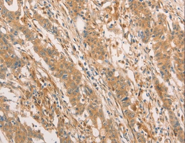 IHC-plus™ Polyclonal Rabbit anti-Human CPB / Carboxypeptidase B Antibody (IHC)