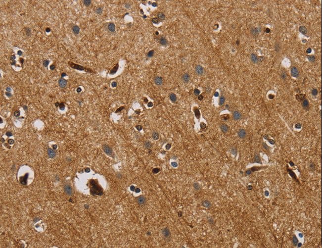 CDw218a / IL18R1 Antibody