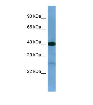 TWF2 / PTK9L Antibody (C-Terminus)