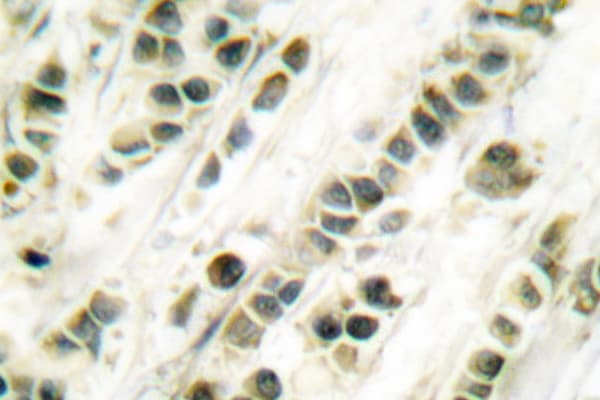 Polyclonal Rabbit anti-Human SRF / Serum Response Factor Antibody (Gly93, IHC, WB)