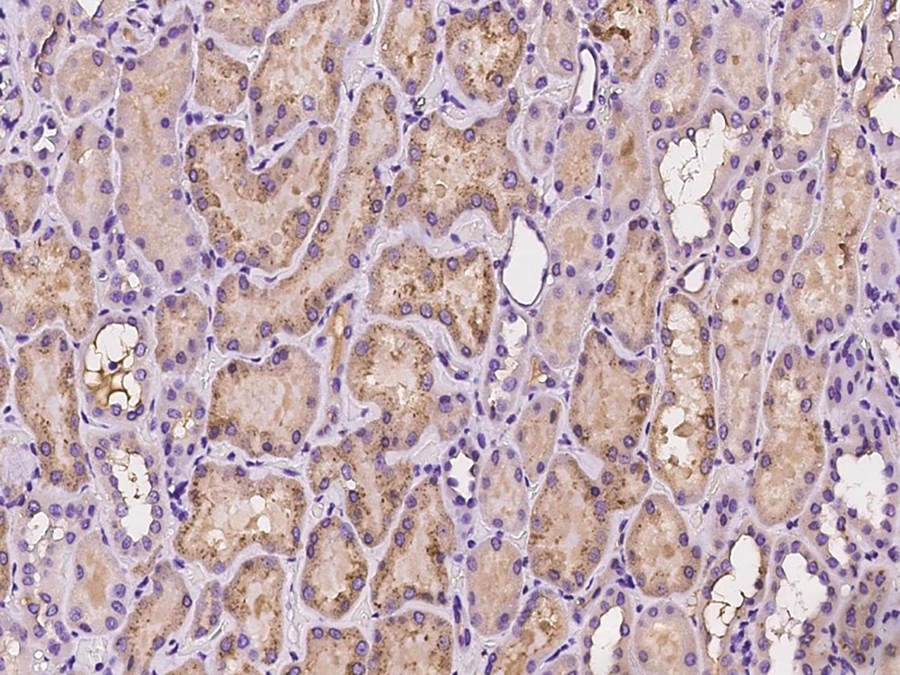 TTR / Transthyretin Antibody