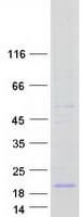 Human ATP6V0C / VATL Protein (Recombinant Myc-DDK (Flag))